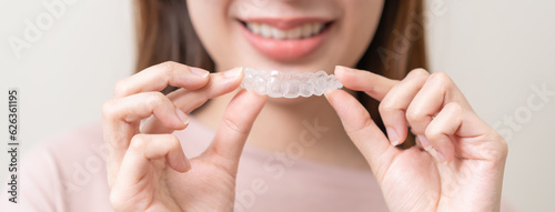 Dental invisible braces, beautiful smiling asian young woman holding invisalign braces, wearing orthodontic silicone trainer, white smile using invisible whitening tray. Stomatology, dental healthcare