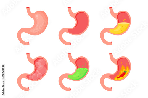 Human stomach. Healthy and unhealthy, empty and full human stomach. Bloating stomach ache, digestive tract pain fullness heaviness stomaches acid heartburn process indigestion