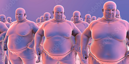 A clone of overweight people, conceptual 3D illustration symbolizing the obesity epidemic