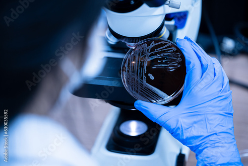 Scientist holding agar plate for diagnosis bacterial or microorganism, blurry microscopy background at laboratory. Selective petri dish with colonies of bacteria under the lens of a microscope.