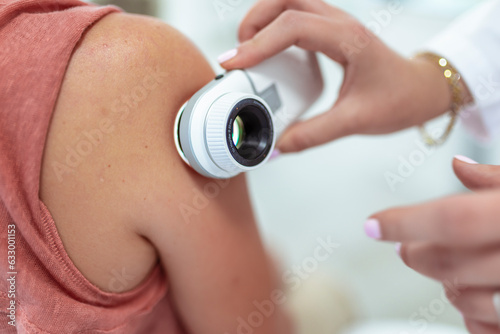 The dermatologist examines the moles or acne of the patient with a dermatoscope. Prevention of melanoma
