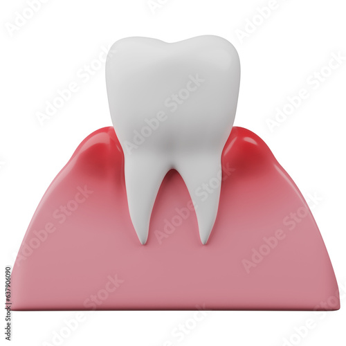 gingivitis and healthy teeth 3D rendering