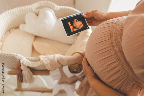 Ultrasound picture pregnant baby photo. Woman holding ultrasound pregnancy image. Concept of pregnancy, maternity, expectation for baby birth