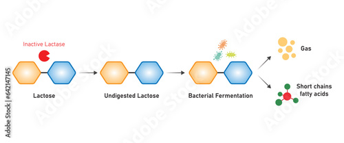 Maldigestion of Lactose Concept Design. Vector Illustration.