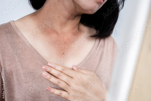 closeup woman have problem with sun exposure, sunburn on neck, checking her dark spot and damaged skin in from of a mirror