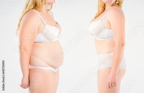 Tummy tuck, woman's fat body before and after weight loss and liposuction on light gray background, plastic surgery concept