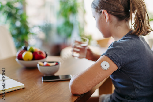 Close up of continuous glucose monitor sensor on girl's arm.