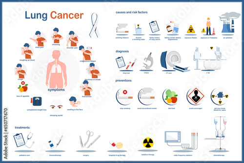 Medical infographic illustration concept of lung cancer,symptoms, causes and risk factors,diagnosis,prevention and treatment of lung cancer.Flat vector illustration.isolated on white background.