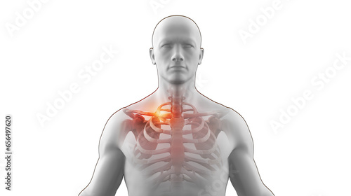 Human x-ray skeleton with broken clavicle