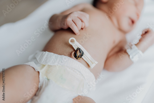 newborn with a clamped umbilical cord