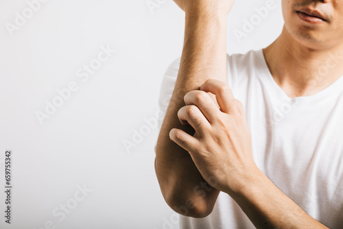 Asian man experiences itchiness on his arm, possibly due to a mosquito bite. Studio shot isolated on white background, depicting discomfort and allergy symptoms like dermatitis and scabies.