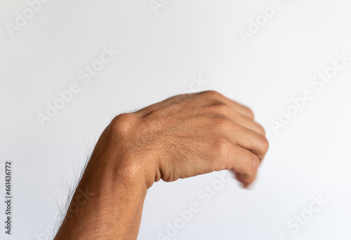 Ganglion cyst on man's hand on white background