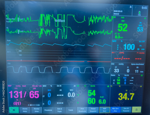 hospital monitor displaying vital signs: heart rate, blood pressure, temperature, and pulse oximetry, highlighting advanced medical technology in patient care