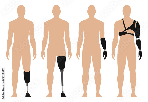 Man with prosthetic arm and leg, medical vector illustration set, isolated on white background.