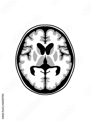 脳画像イラスト（基底核レベル灰白質色分け）