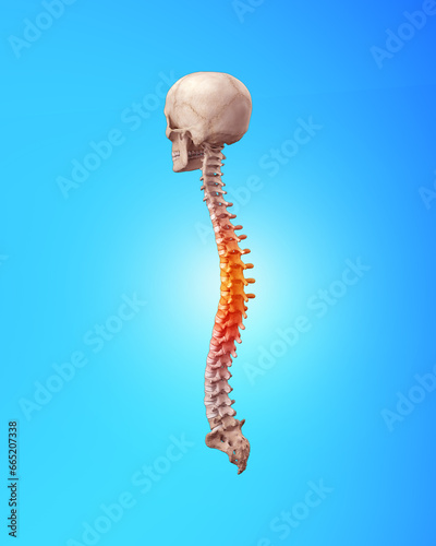 Human spine with lumbar with pain in thoracic region