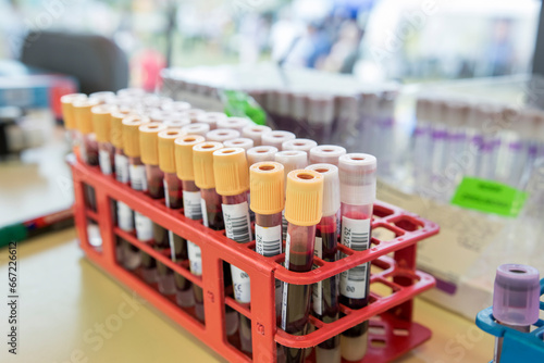 Próbówki z krwią do badania stojące na stole