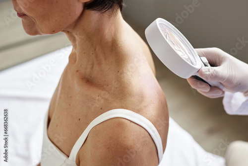 Close up of doctor holding magnifying glass while examining female patient in dermatology clinic, copy space