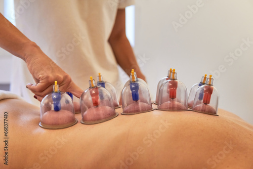 Therapist checking patient spine during cupping treatment. Healthcare suction massage on the spa