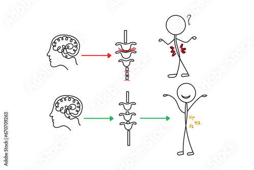 Line art of chiropractic spine adjustments. Spinal injuries and neural connections. Brain and spinal cord physiology and anatomy. Connection.