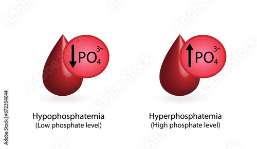 Hyperphosphatemia, high plasma phosphate level and Hypophosphatemia, low plasma phosphate level. phosphate excess and deficit electrolyte disorders, blood droplet, Scientific Vector illustration.