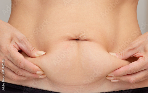 Hands on belly pressed skin to show sagging skin after diet and stretch marks after pregnancy over gray background