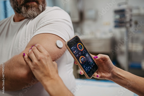 Doctor connecting continuous glucose monitor with smartphone, to check blood sugar level in real time. Obese, overweight man is at risk of developing type 2 diabetes. Concept of health risks of