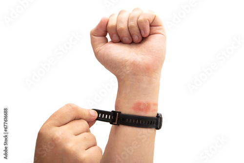 A man tightens a fitness bracelet with a silicone strap on his wrist, close-up. Concept of allergy and skin irritation from silicone watch strap, dermatitis. Copy space for text