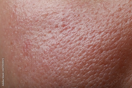 Closeup view of human oily skin as background