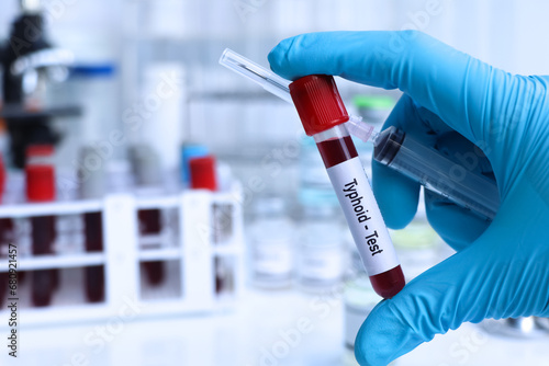 Typhoid test to look for abnormalities from blood