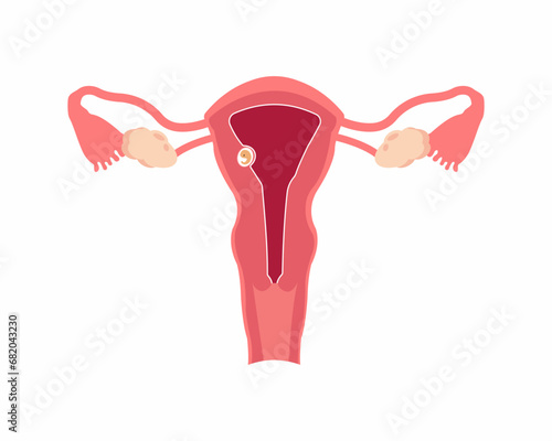 Embryo implantation embryo wall of the uterus embryo development from ovulation to implantation female reproductive system 