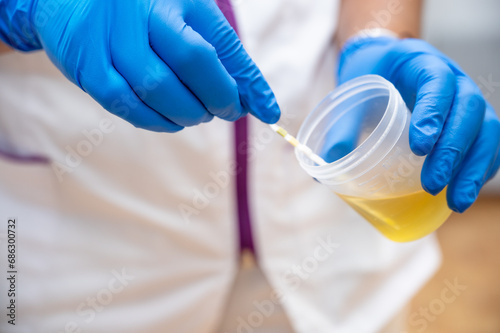 Close up of Nurse Hand holding urine sample container for medical urine analysis with color strip. High quality photo