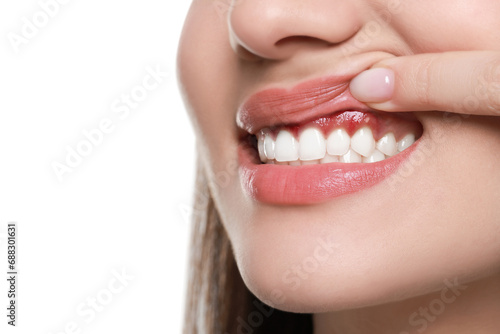 Woman showing inflamed gum on white background, closeup