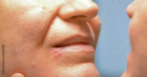 A close-up shot of the face of a 50+ woman looking at herpes on her lip and her facial skin in the mirror.