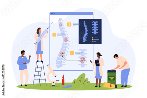 Diagnosis and treatment of chronic spinal diseases vector illustration. Cartoon tiny people check xray of spine for problem vertebrae, therapy for inflammation and intervertebral cartilage hernia