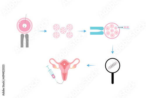 Preimplantation Genetic Diagnosis (PGD) Scientific Design. Vector Illustration.