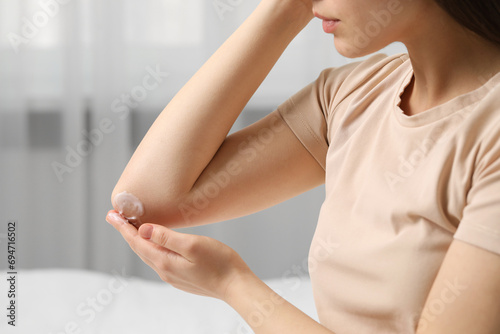 Young woman with dry skin applying cream onto her elbow indoors, closeup