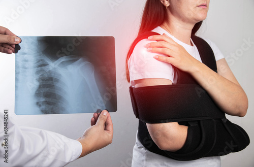 The doctor holds in his hand a medical x-ray of a dislocated humerus and a fractured collarbone against the background of a girl patient whose shoulder hurts. Fixing bandage for the shoulder joint. 