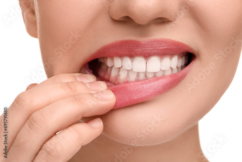 Woman showing her clean teeth on white background, closeup