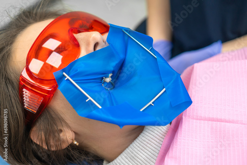 Close-up of a young female patient with a dental cofferdam installed in a dental office. Dentist uses a dental dam to isolate the tooth