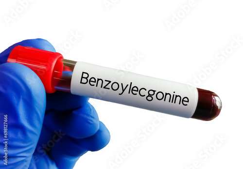 Blood sample for Benzoylecgonine test, it is the major metabolite of cocaine. It is formed by hydrolysis of cocaine in the liver, 