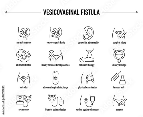 Vesicovaginal Fistula symptoms, diagnostic and treatment vector icons. Line editable medical icons. 