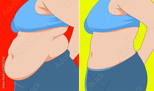 A woman's body with belly fat. Before, after. Healthcare illustration. Vector illustration. 