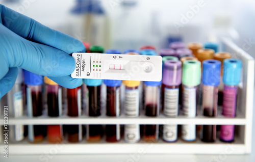 test Cassette for Covid-19 variant included Pirola BA.2.86. Blood tubes test in background. Antigen test kit for SARS‑CoV‑2 self testing 