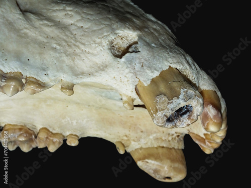 Tooth fistula