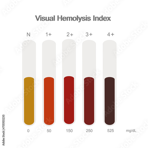 The Hemolysis Visual index were interpreted in the level of Normal or Zero and plus of 1 to 4 that represent in the chart of red color of serum and concentration of hemoglobin.