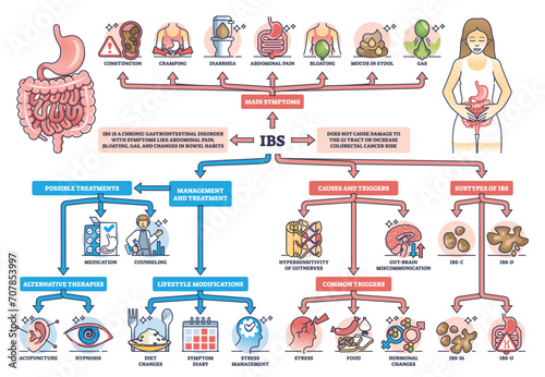 IBS or irritable bower syndrome causes and condition symptoms outline diagram. Labeled educational scheme with digestive system chronic problems vector illustration. Medical gastrointestinal disorder
