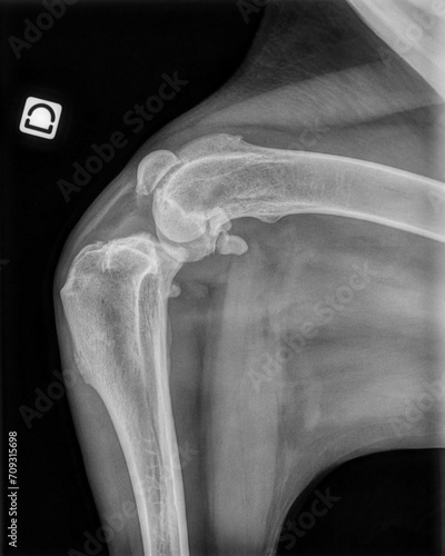 X-ray of a Saint Bernard dog's knee with a torn anterior cruciate ligament