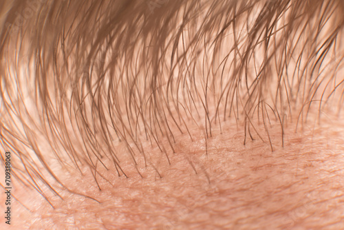 The Hair line on the man forehead - macro close up