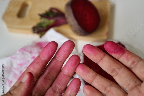 Woman's purple stained hand after peeled and cutting beetroot. After making beet root into a juice with manual process.